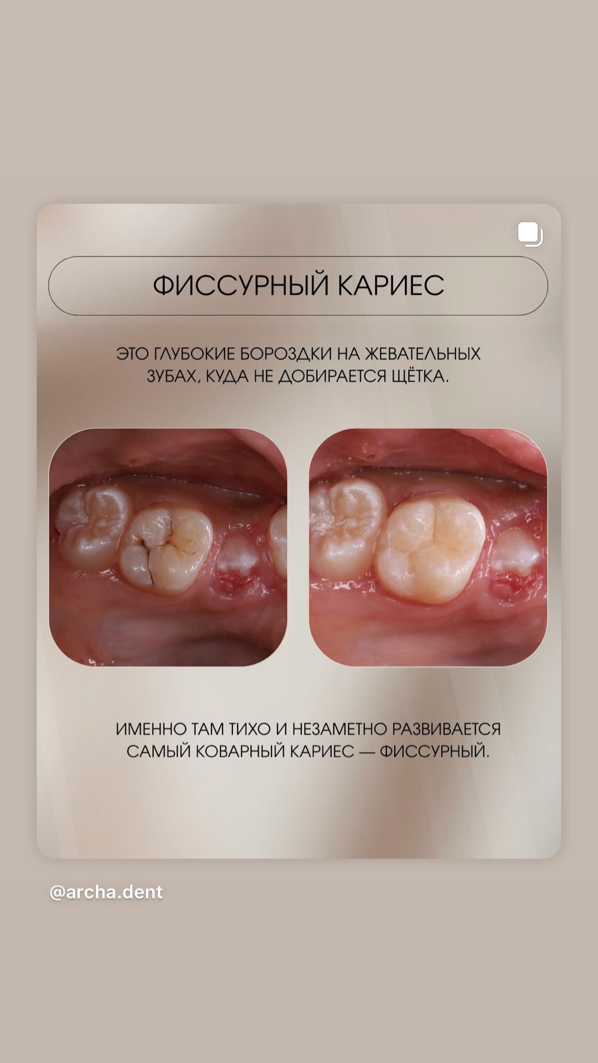 Детская стоматология