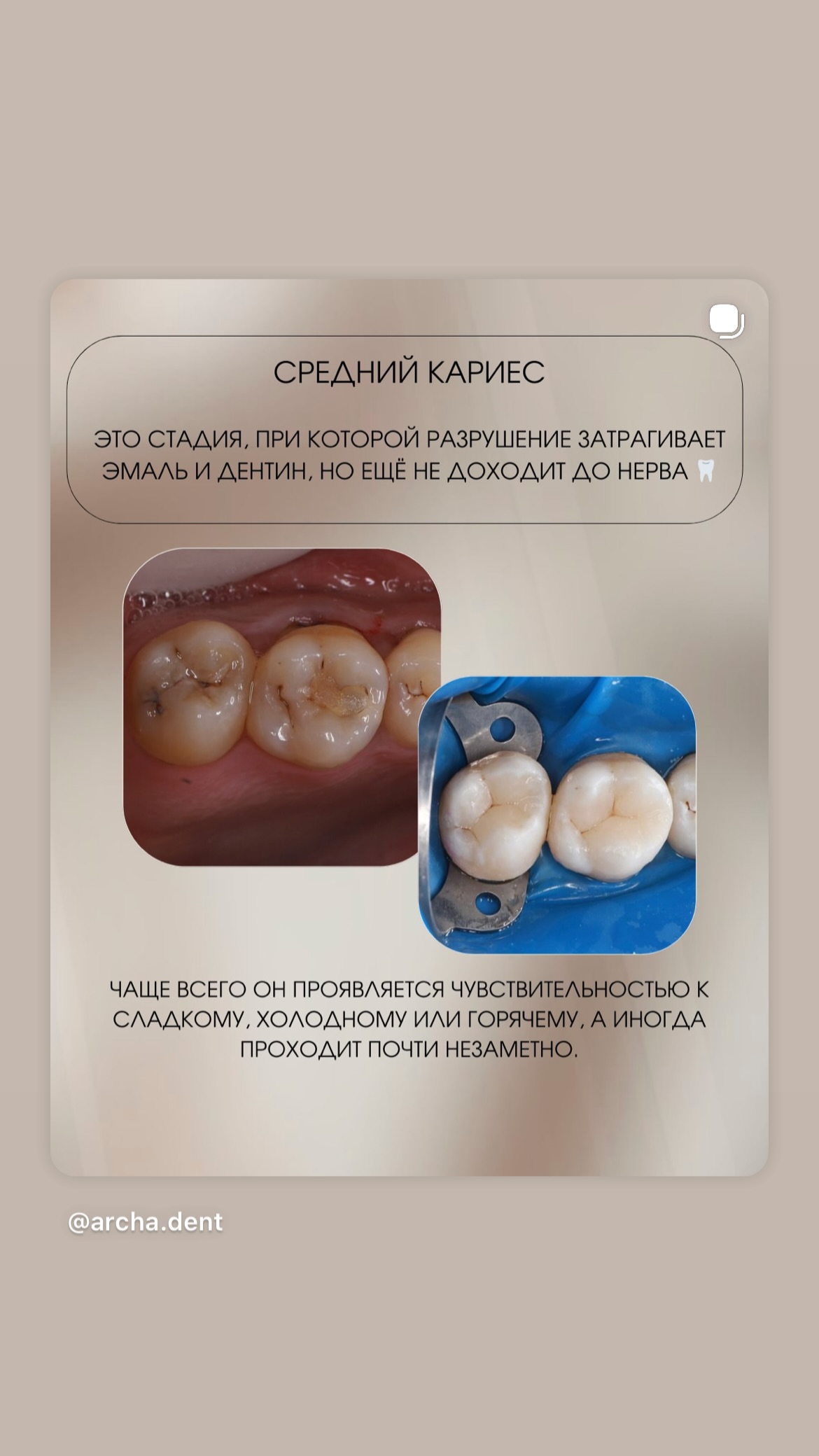 Archa Dent лечение