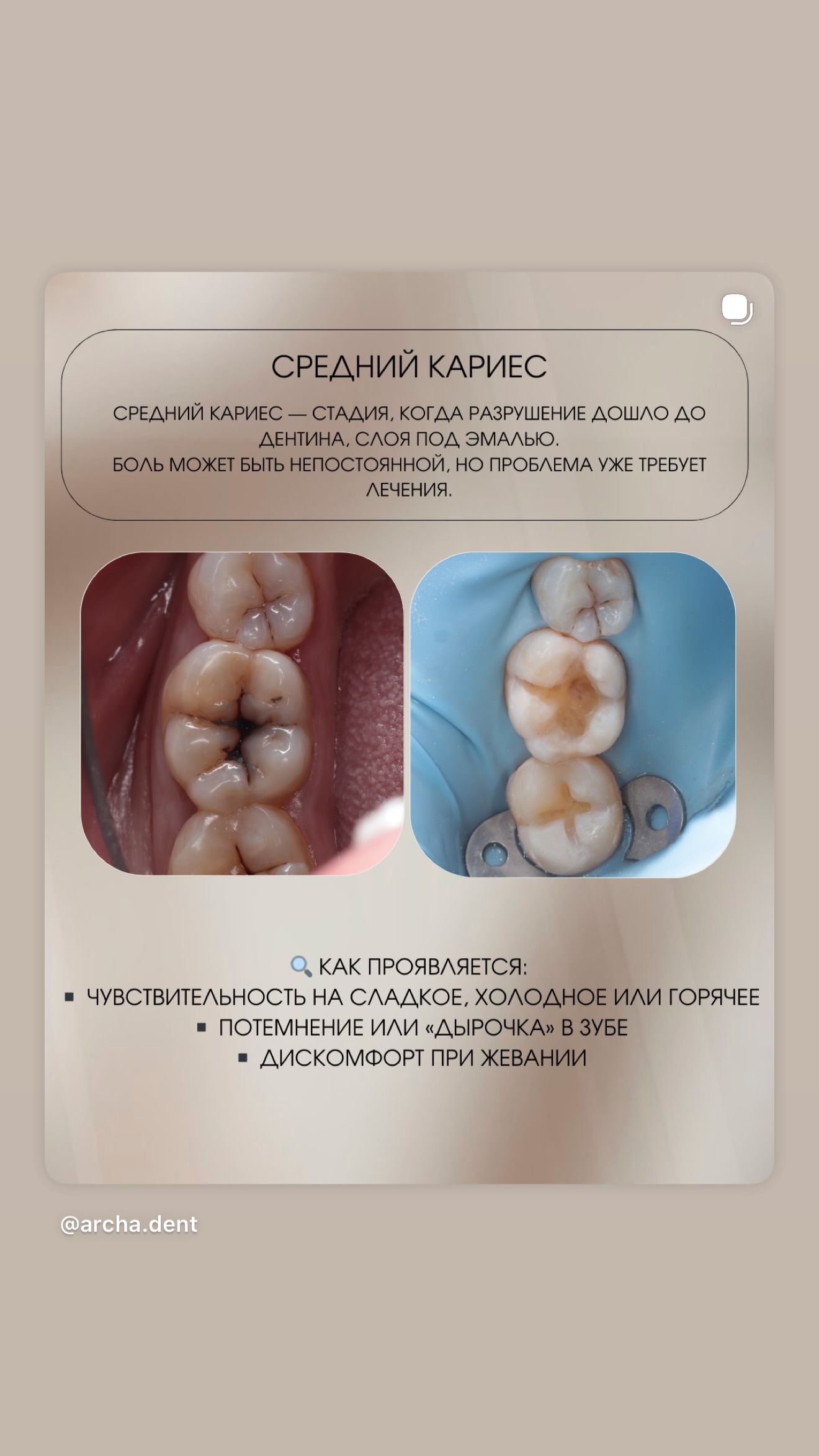 Archa Dent стоматология