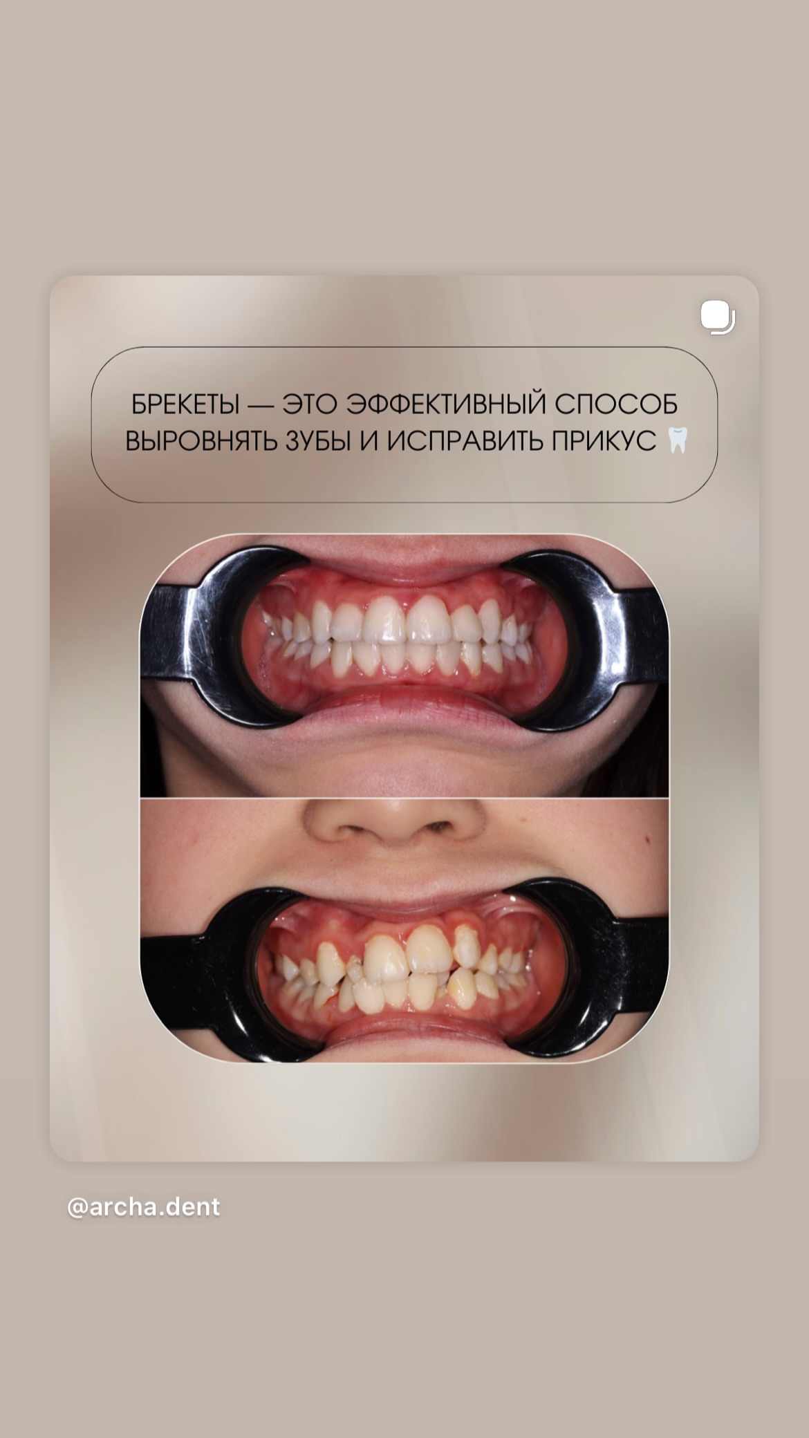Ортодонтия Archa Dent