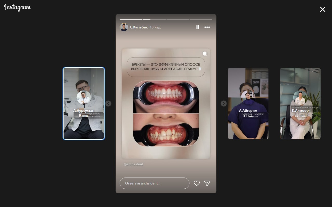Брекеты и ортодонтия