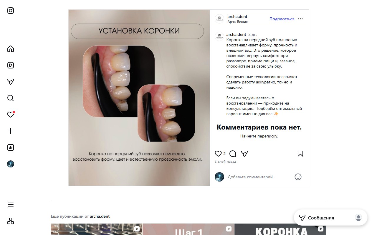 Коронка после